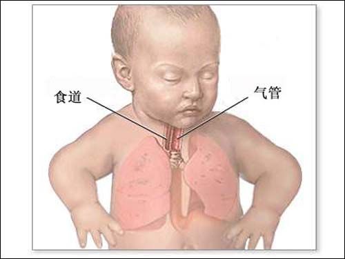 图片[1]-秋季食道癌易高发 白领如何防治食道癌-起舞食谱网